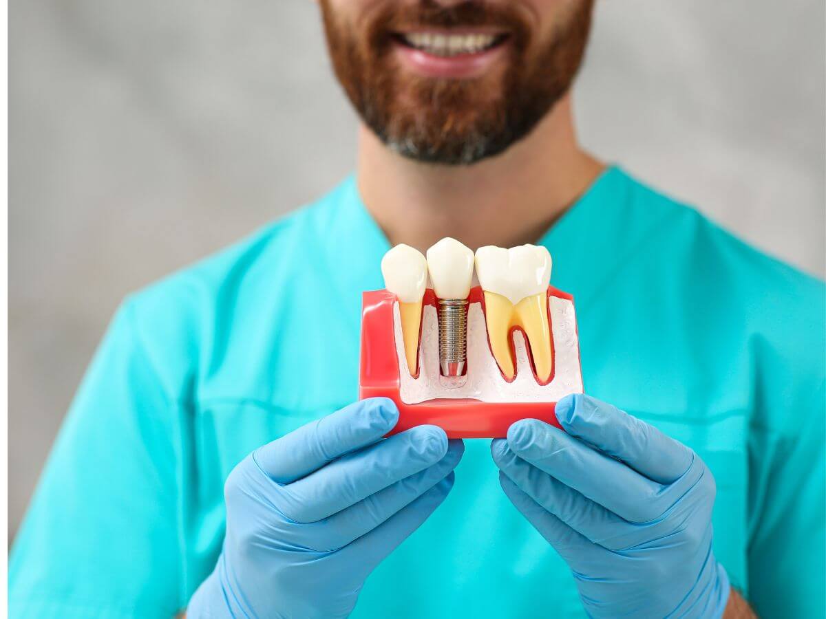 Dental Implants (Permanent Replacement for Missing Teeth)