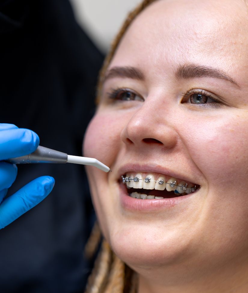 How Braces Work to Straighten Teeth